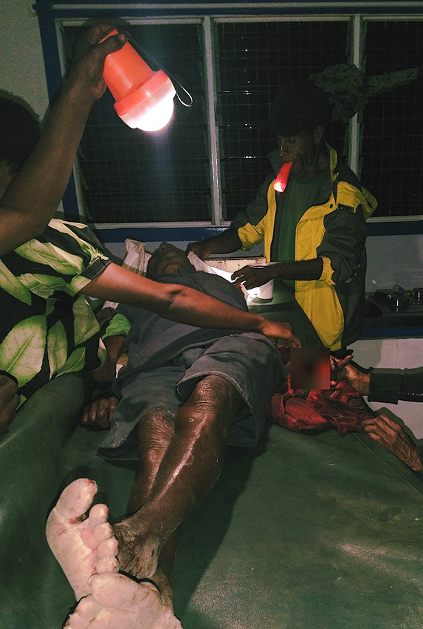 Health workers treat a man’s hand injured in a tribal dispute, lit by torchlight