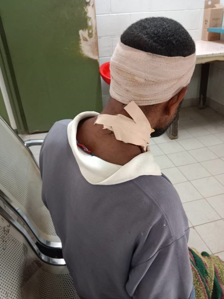 At Kundiawa A&E, John got his stab wounds treated (credit: Andrew Yalbai)